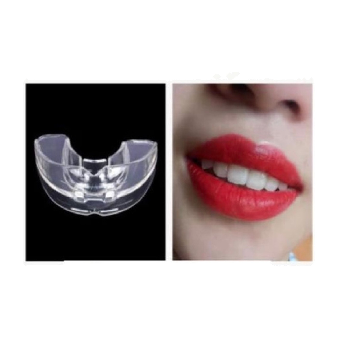 PROTECTOR DENTAL
